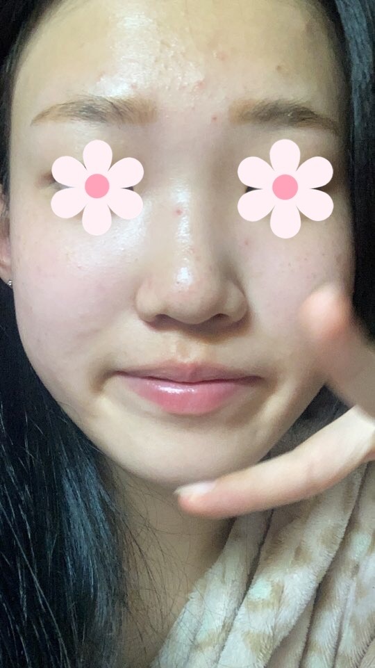 이미지를 불러올 수 없습니다.