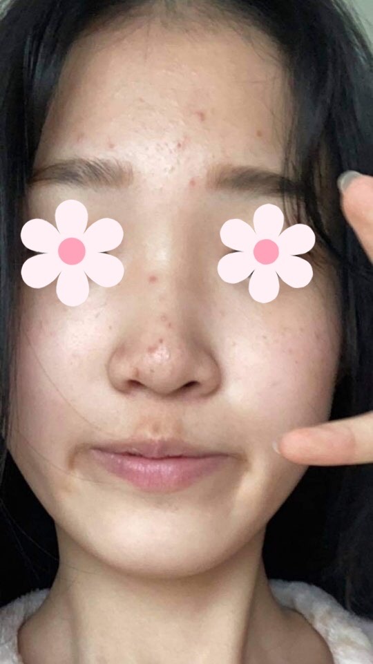 이미지를 불러올 수 없습니다.